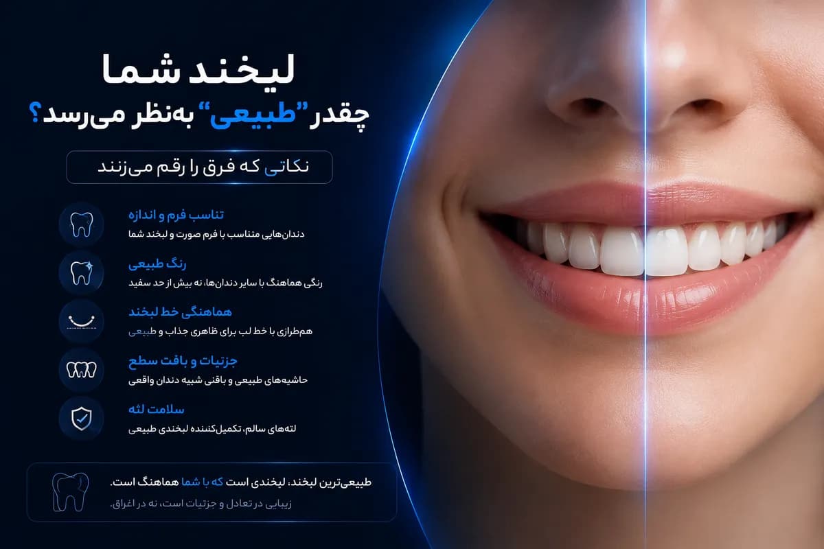 لبخند شما چقدر "طبیعی" بهنظر میرسد؟ نکاتی که فرق را رقم میزنند