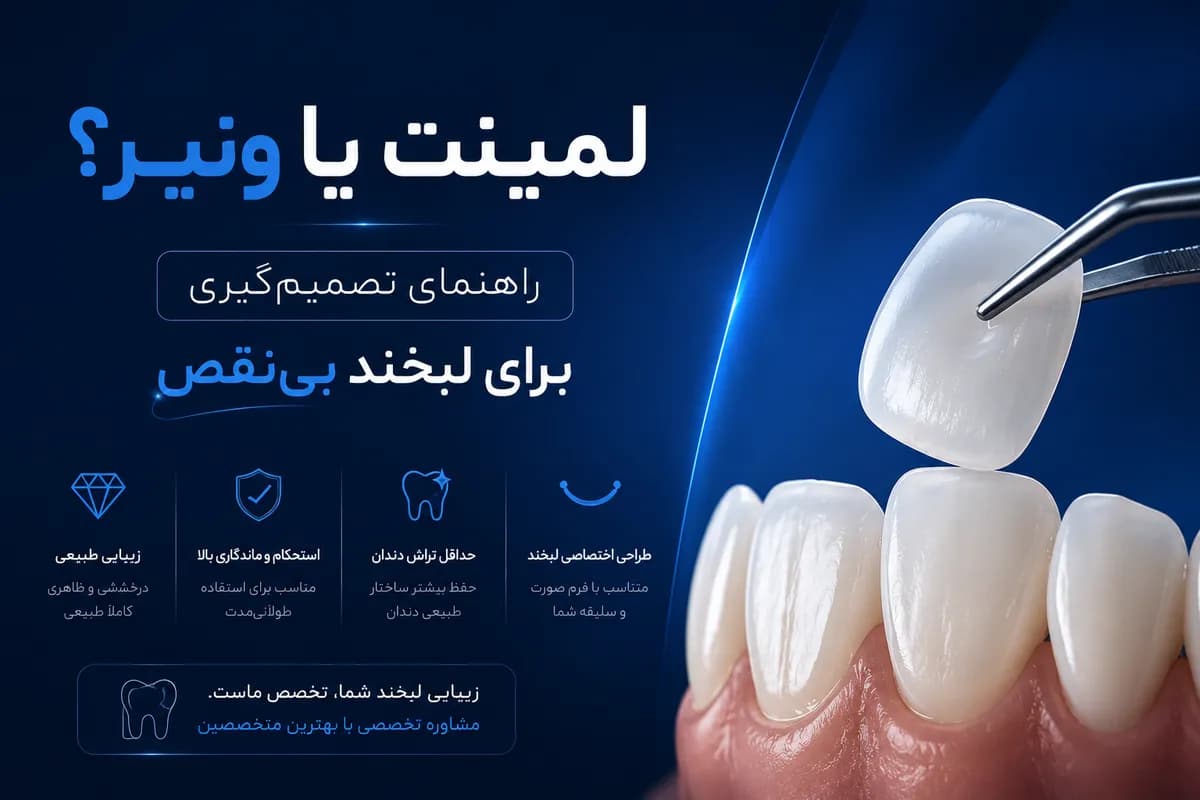 لمینت یا ونیر؟ راهنمای تصمیمگیری برای لبخند بینقص